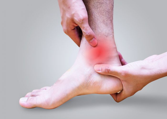 Dottor Attilio Basile Chirurgia del piede e della caviglia artrosica (artrodesi, sostituzioni protesiche delle articolazioni del piede e della caviglia
