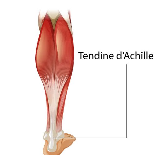 La più comune patologia del tendine d’Achille è la sua infiammazione.