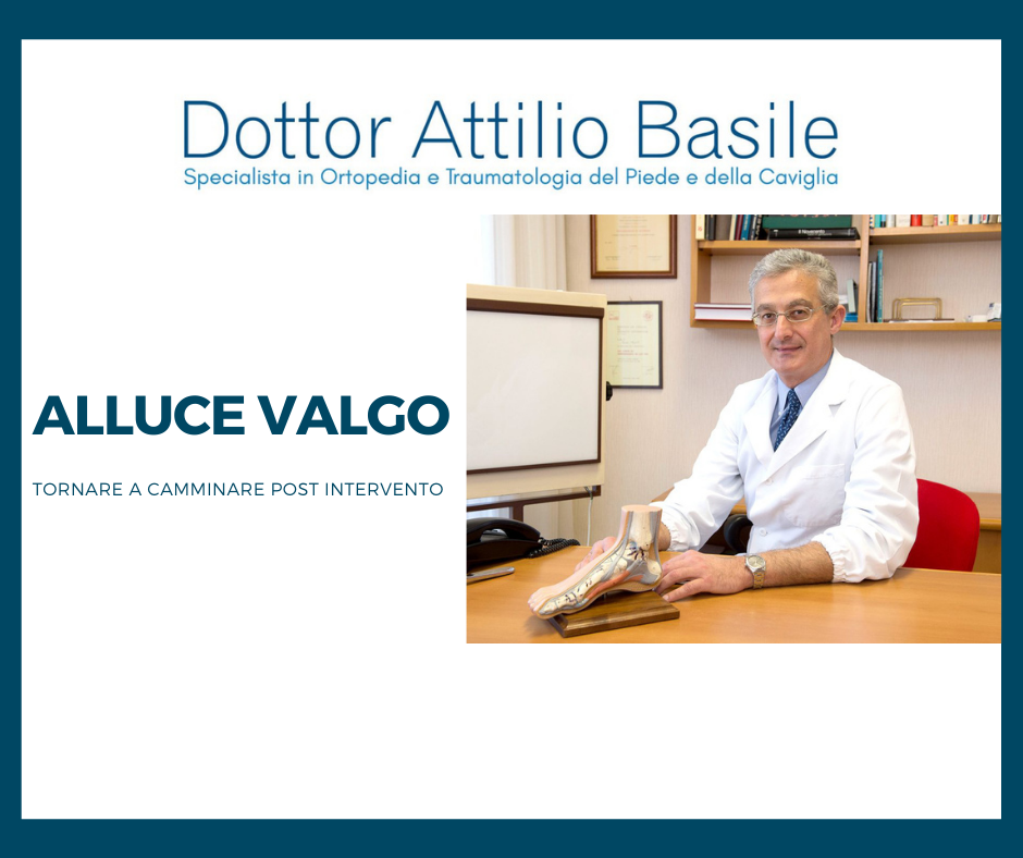 Post intervento alluce Valgo - Dr Attilio Basile