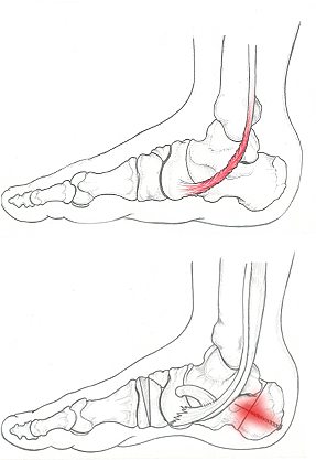Ortopedico specialista piedi - Dr Basile
