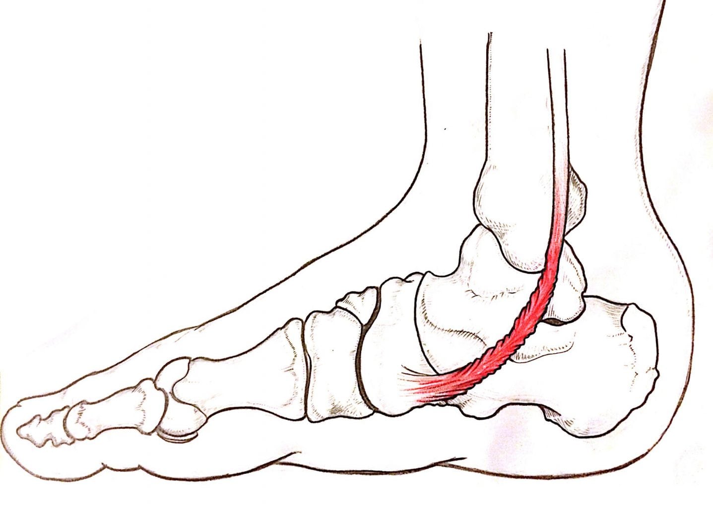 tendini caviglia infiammati - Dr Basile