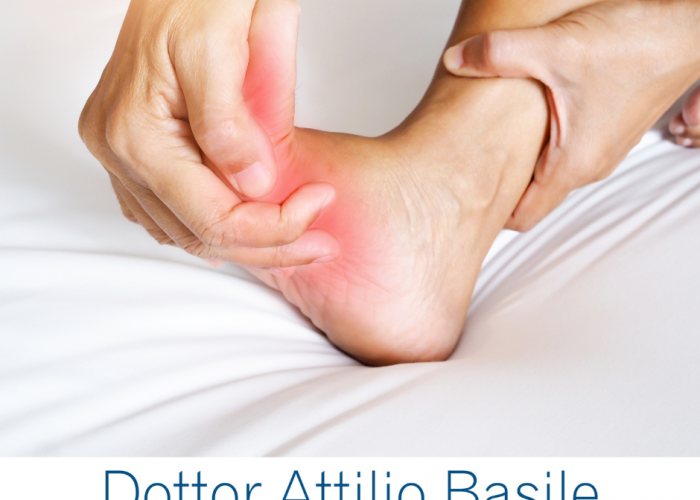 Artrosi piede e caviglia, ecco come riconoscerle - Dr. Attilio Basile
