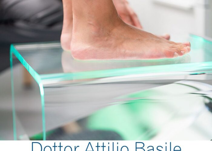 piede piatto sintomi e rimedi Dottor Attilio Basile