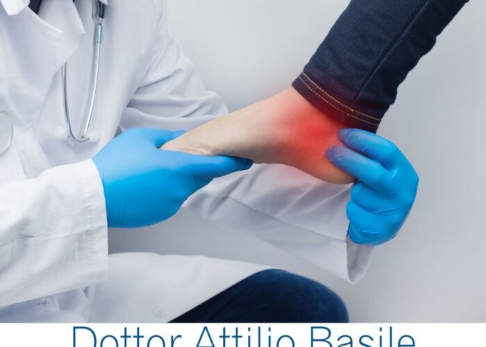 infiammazione tendine tibiale posteriore Dr. Basile