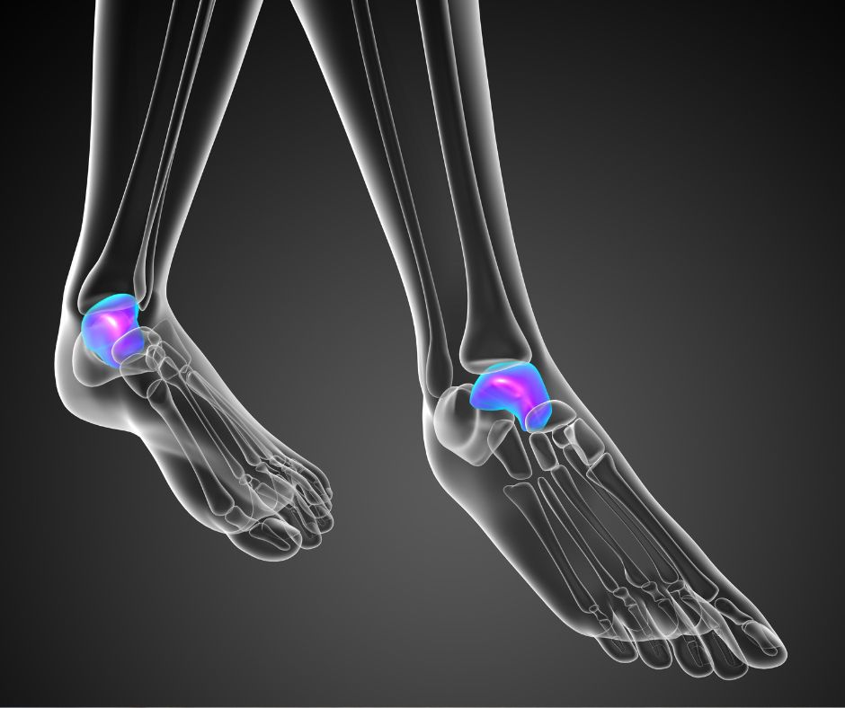 Frattura del Malleolo Sintomi e quando sospettarla - Dr. Basile