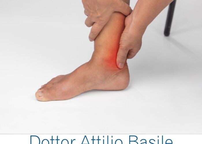 Instabilità caviglia - Dottor Basile Specialista Ortopedia e Traumatologia del piede e della caviglia