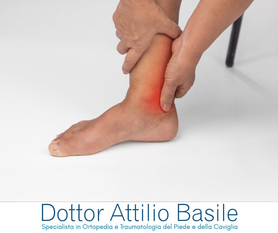 Instabilità caviglia - Dottor Basile Specialista Ortopedia e Traumatologia del piede e della caviglia