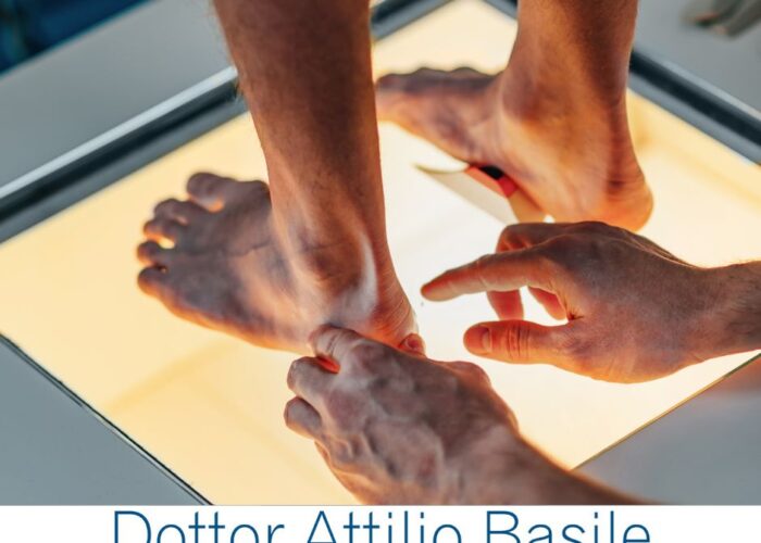 Piede piatto nell'adulto - Dottor Attilio Basile specialista ortopedia e traumatologia piede e caviglia Roma