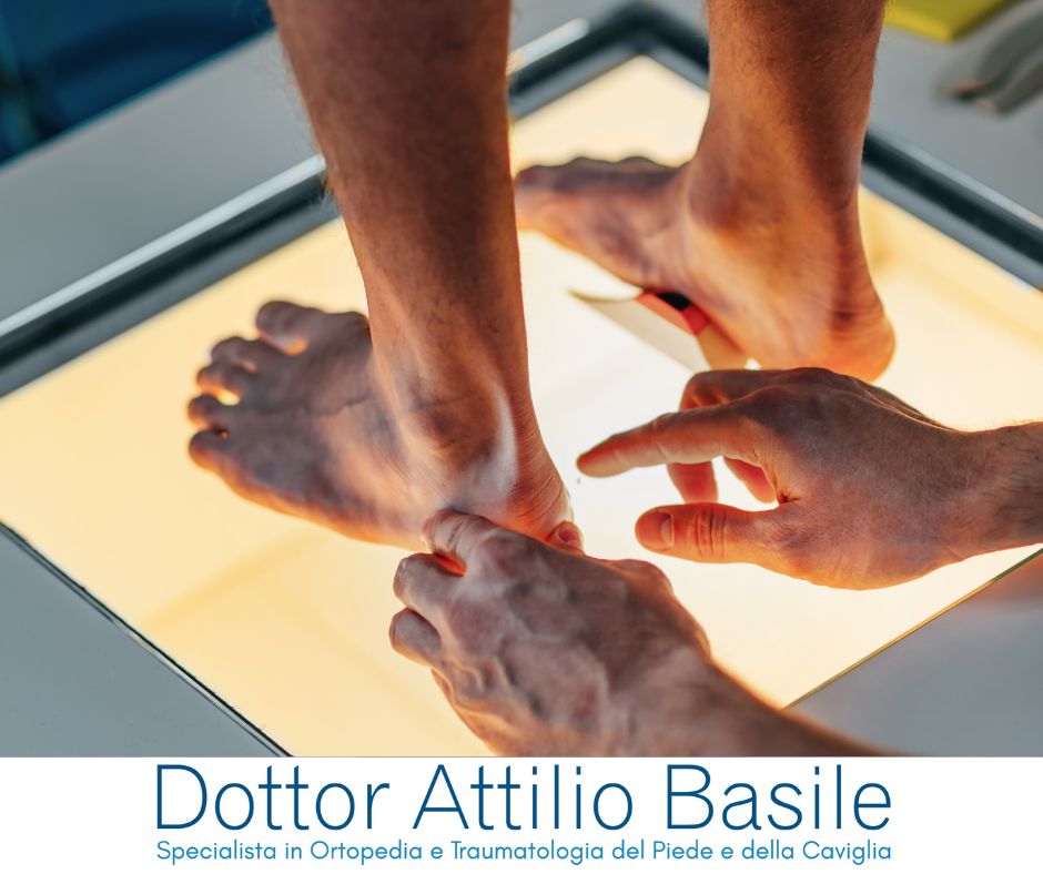 Piede piatto nell'adulto - Dottor Attilio Basile specialista ortopedia e traumatologia piede e caviglia Roma
