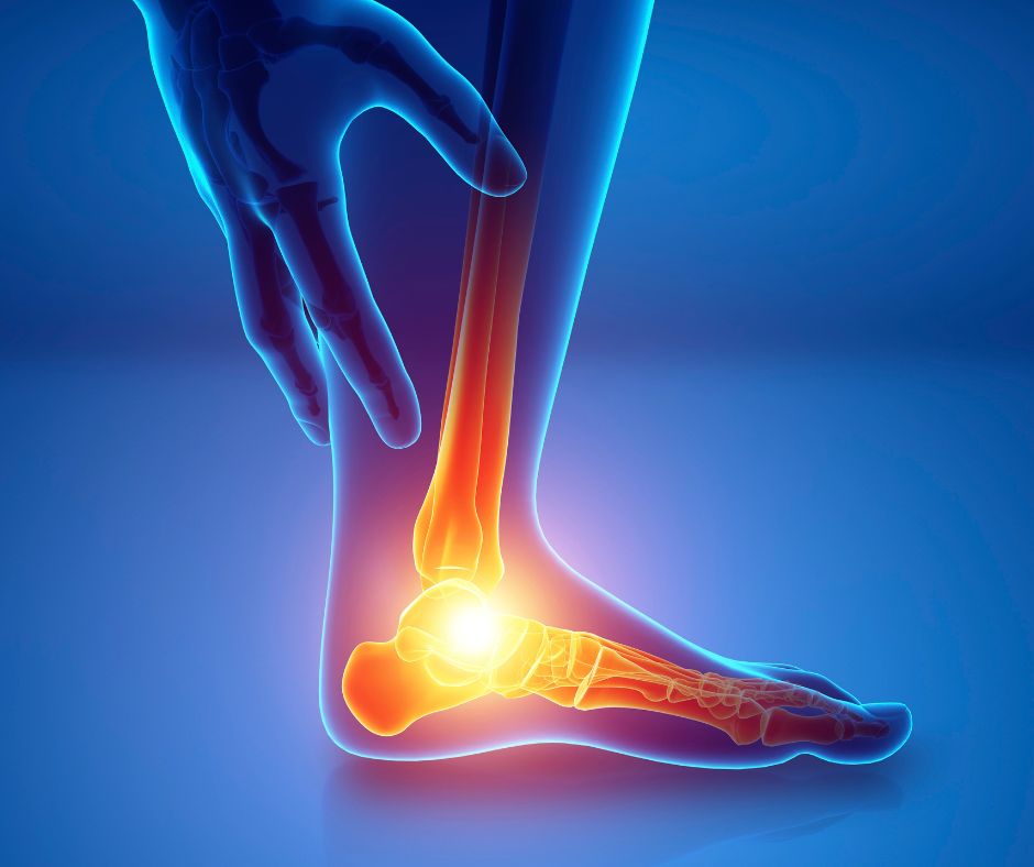 Sidrome del seno del tarso Dr. Basile