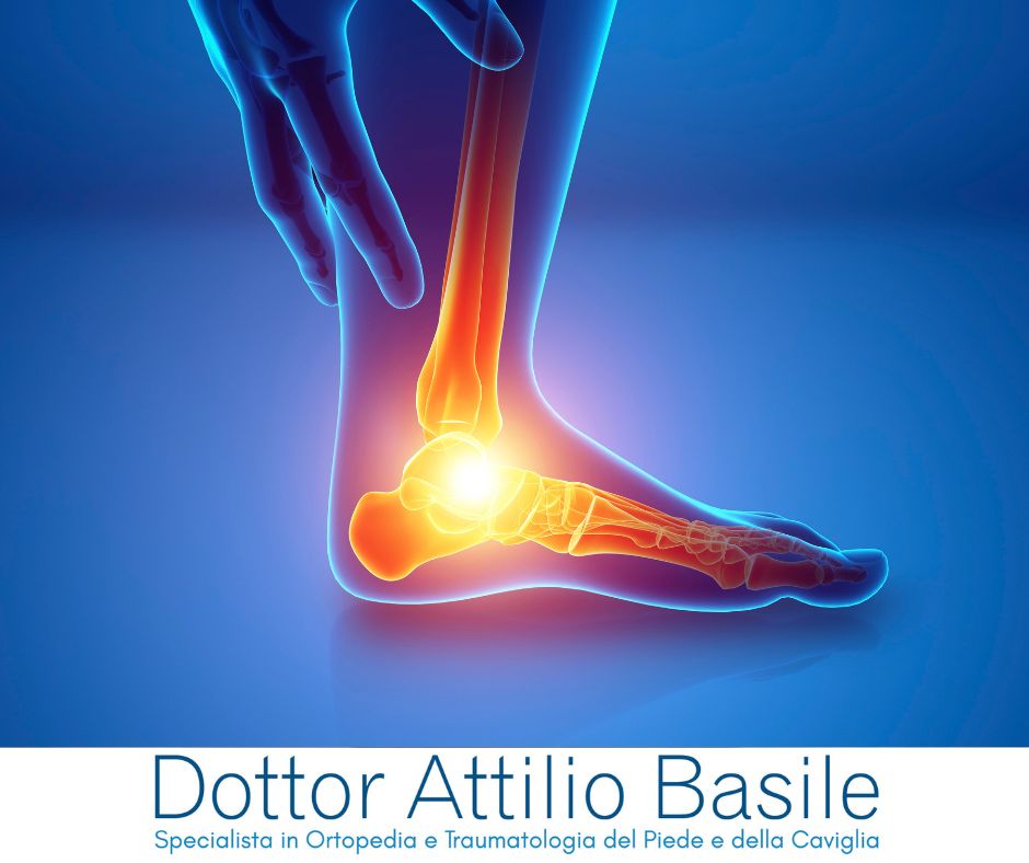 Sindrome del seno del tarso cos’è, come si riconosce e come si cura - Dr. Basile