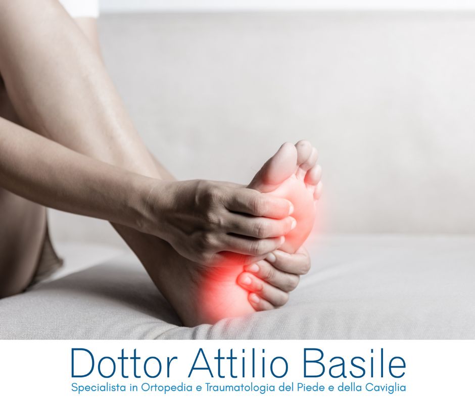 Fascite plantare e spina calcaneare - Dottor Attilio Basile