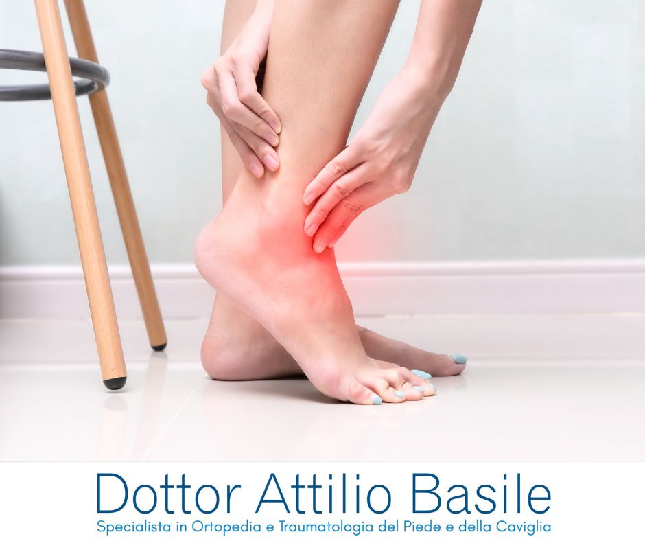Dolore alla caviglia senza trauma - Dr Basile